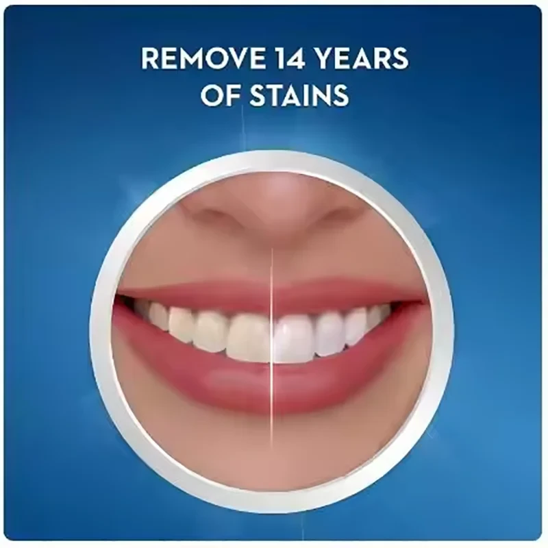 Professional Teeth Whitening Strips